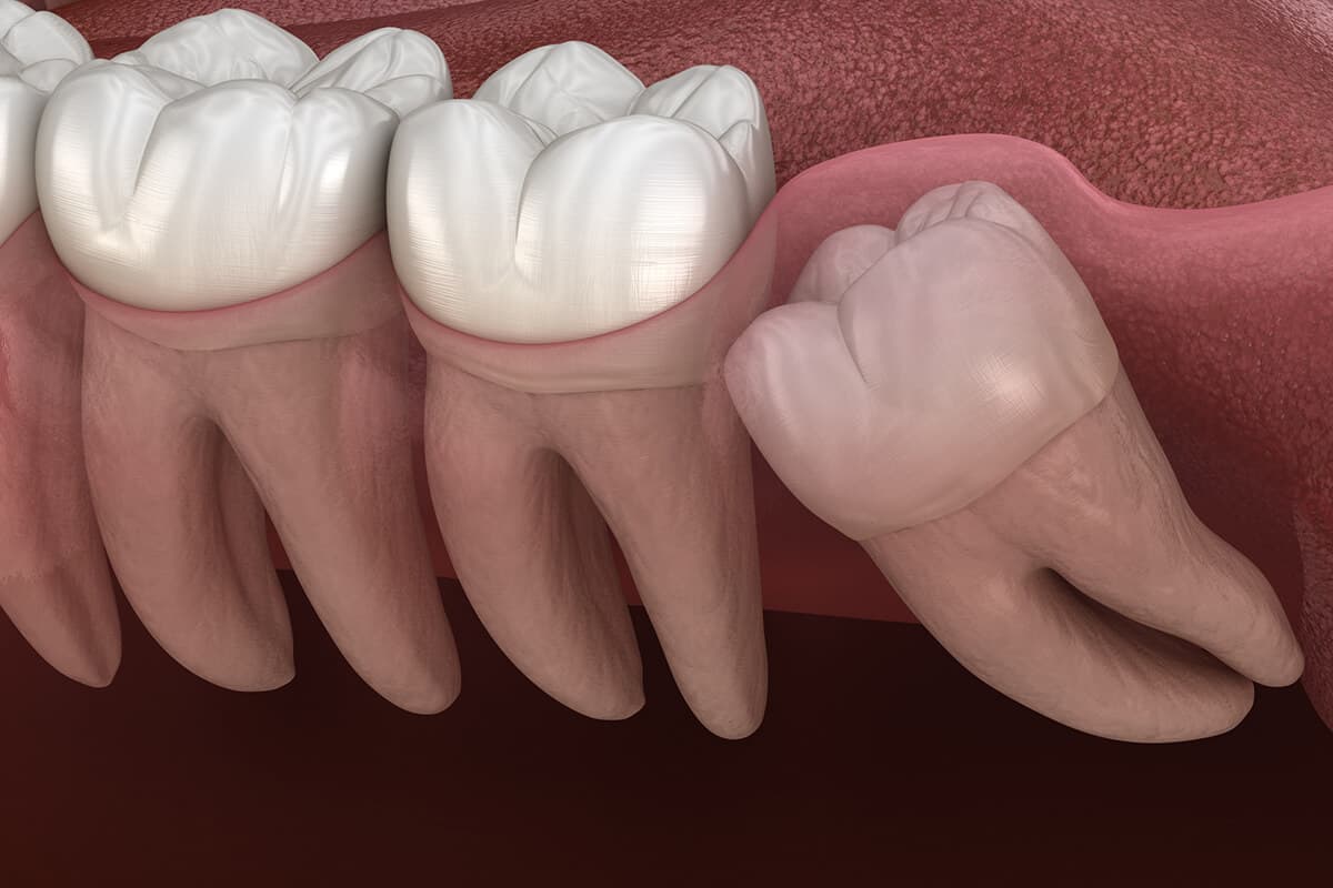Teen smiling in dental chair